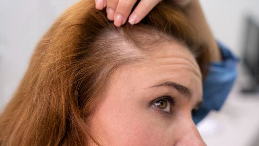Close-up of a woman showing thinning hair near her scalp.