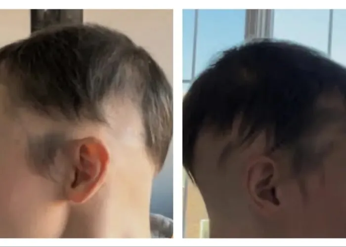 48edb7e-3408-0c6f-ac2a-11cfb7c803_Untitled-design-_1_-1-700x500