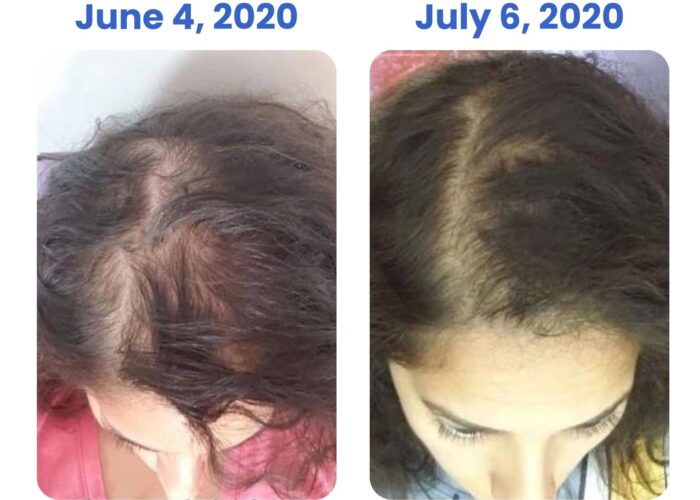 imgi_11_d677e1e-e1c-7fcf-ec66-bb0452e52f3f_41383b36-1716-4f33-967c-0703ad0362a8-700x500