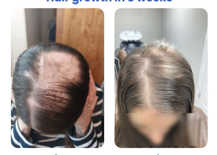 imgi_12_bc85648-408-7e77-a555-708d841afa2_b9de2627-bc9b-42fc-a19a-f689b91f350f-700x500