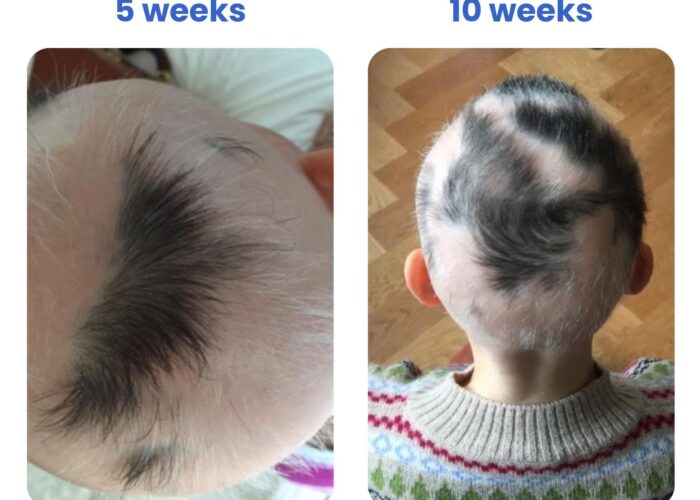 imgi_13_c26586c-0f7f-d17-2225-ceba6b7a7e00_fcead759-7b74-4c2f-8032-095c893cee6e-700x500