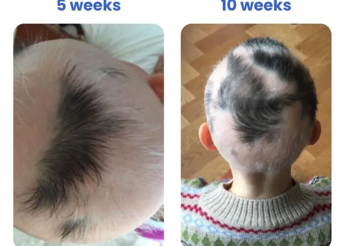 imgi_13_c26586c-0f7f-d17-2225-ceba6b7a7e00_fcead759-7b74-4c2f-8032-095c893cee6e-700x500