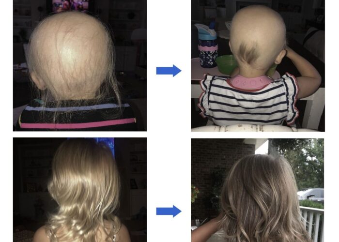 imgi_14_c813b83-803-474e-6faa-bc04f71abb_b3d78c06-3c55-4ba5-8837-57089d62c6c5-700x500