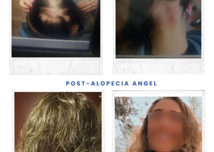 imgi_18_73687b-ef7f-7f-fa1-e4778341c646_b1973c48-6e9a-489c-940c-6dd4ec51f06f-700x500