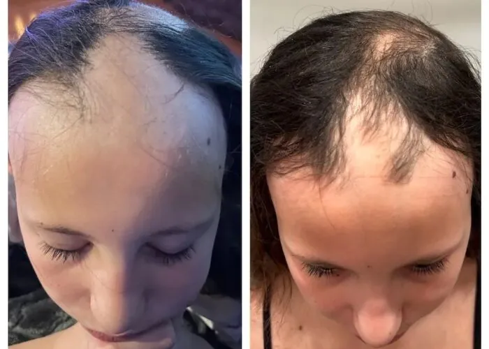 imgi_3_ff58e3-2b53-7044-e320-bfb46bb31f33_aa27a05c-a1c3-448a-bdaf-6ece1fd3a5e7-700x500