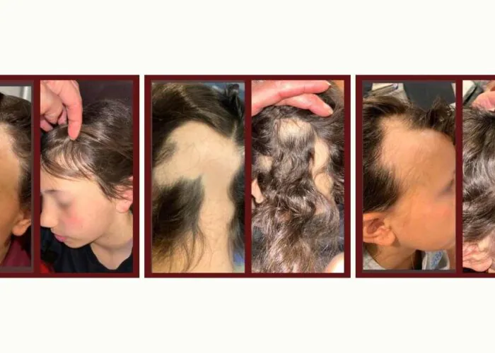 imgi_6_cfac52b-dccf-567e-c27d-e0343f63ab2_ecf6de4a-0596-4ead-9e34-b74f21d3fd0a-700x500