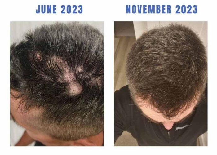 imgi_9_13ed8d-b4c7-873b-7ad6-a4f2fe1774d_JUne_2023-700x500